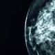 AI Detects Breast Cancer Missed by Human Doctors, Saving Lives